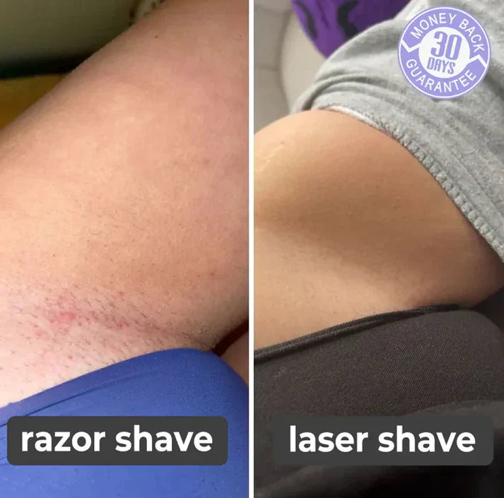 Painless Laser Touch Hair Remover